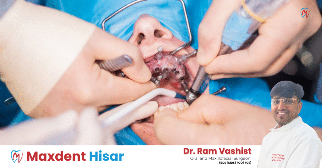 oral surgery by maxdent hisar